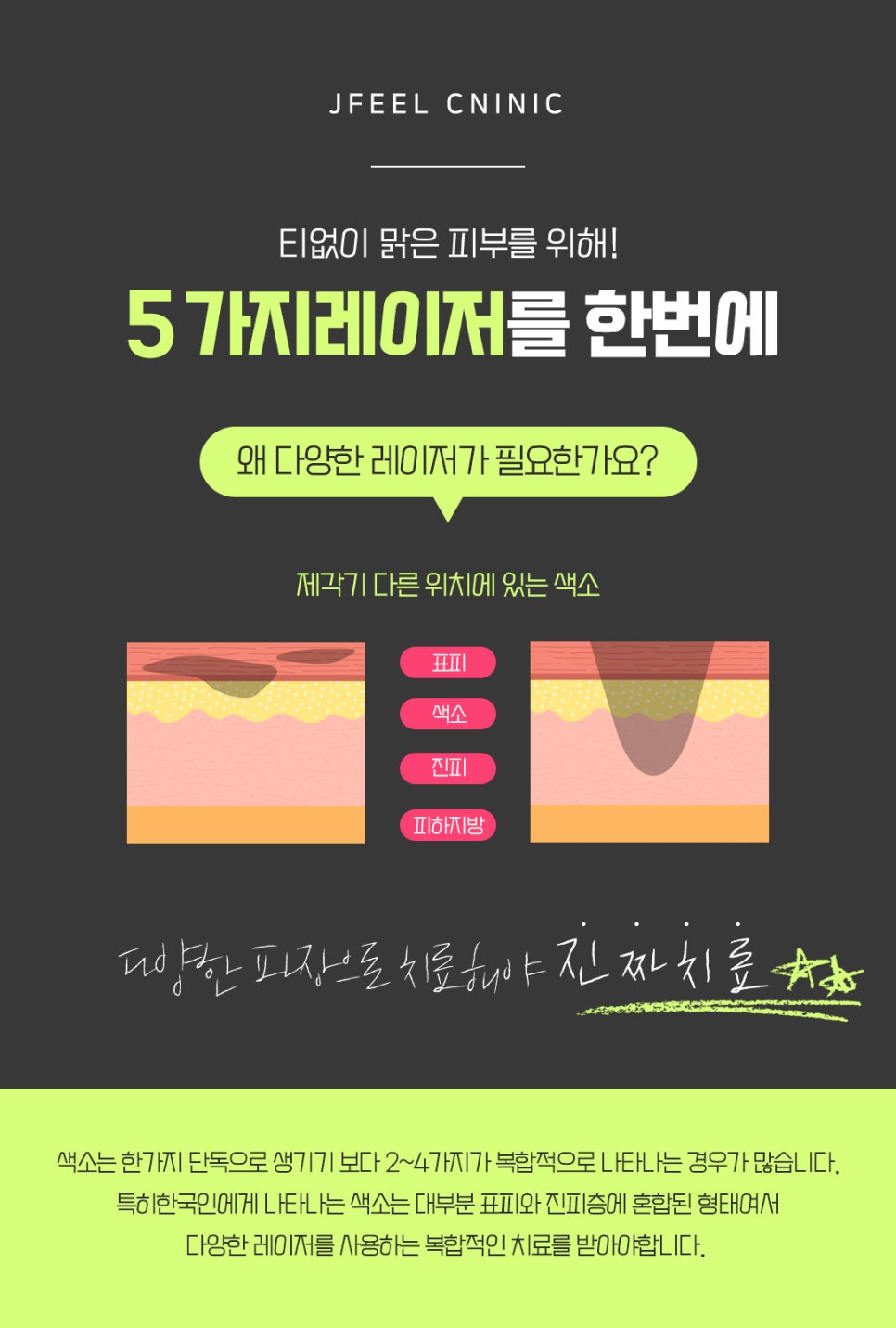 기미 잡티 등 색소 질환을 빠르게 개선할 수 있는 레이저? 관련 이미지 3
