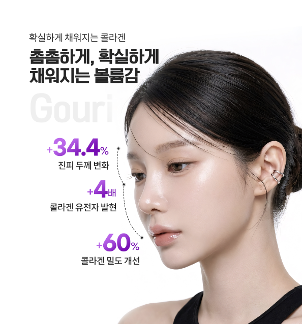Gouri vs. Fillers: What’s the Difference? An Easy Guide from Skin Elasticity to Side Effects image 14