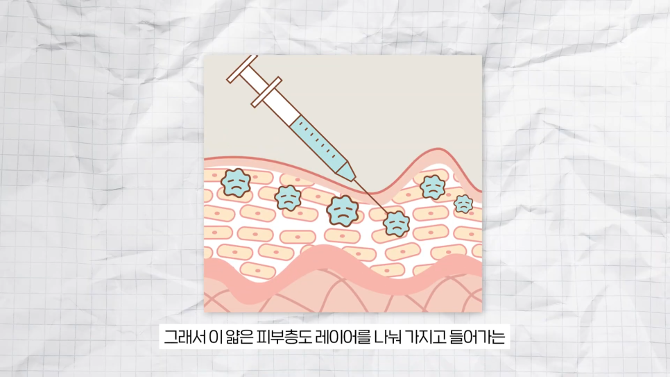 필러가 싫다면? 눈가, 팔자, 주름 해결하는 울트라콜 관련 이미지 16