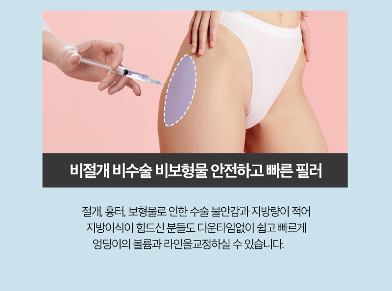 Solving Lower-Body Line Concerns, Creating Apple Hips with J-FILL Hip Filler and Butt Filler image 6