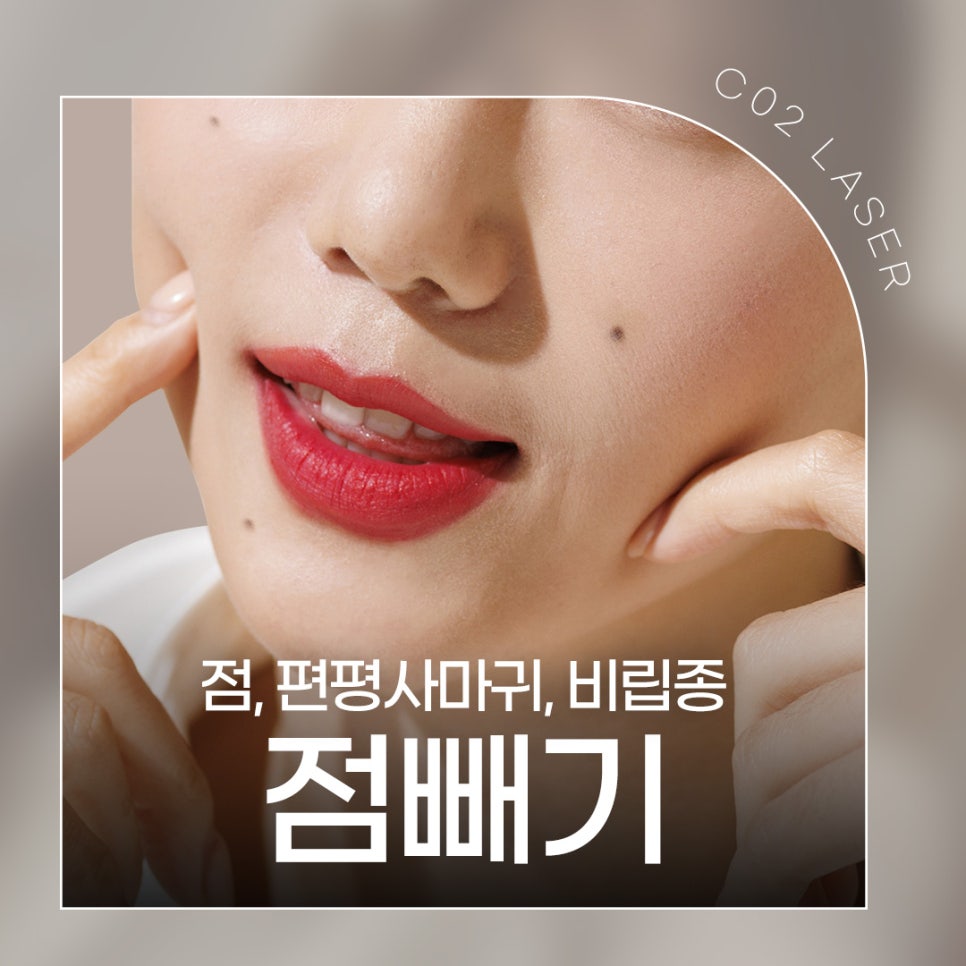 점빼기피부과에서 흉터 없이 제거 관련 이미지 1