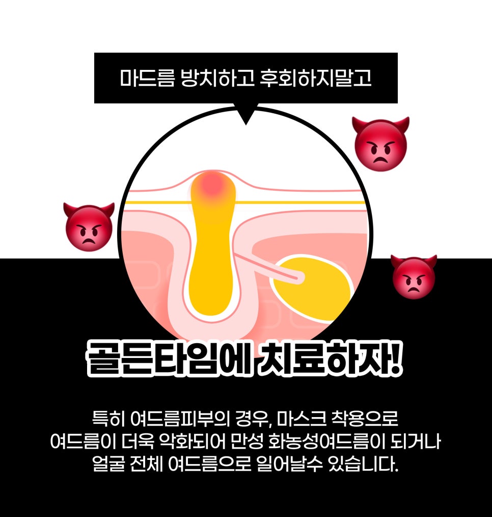 마스크피부염 더 이상 생기지 않도록 관련 이미지 2