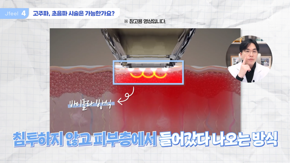 임산부피부과 시술 가능한가요? Q&A 관련 이미지 15