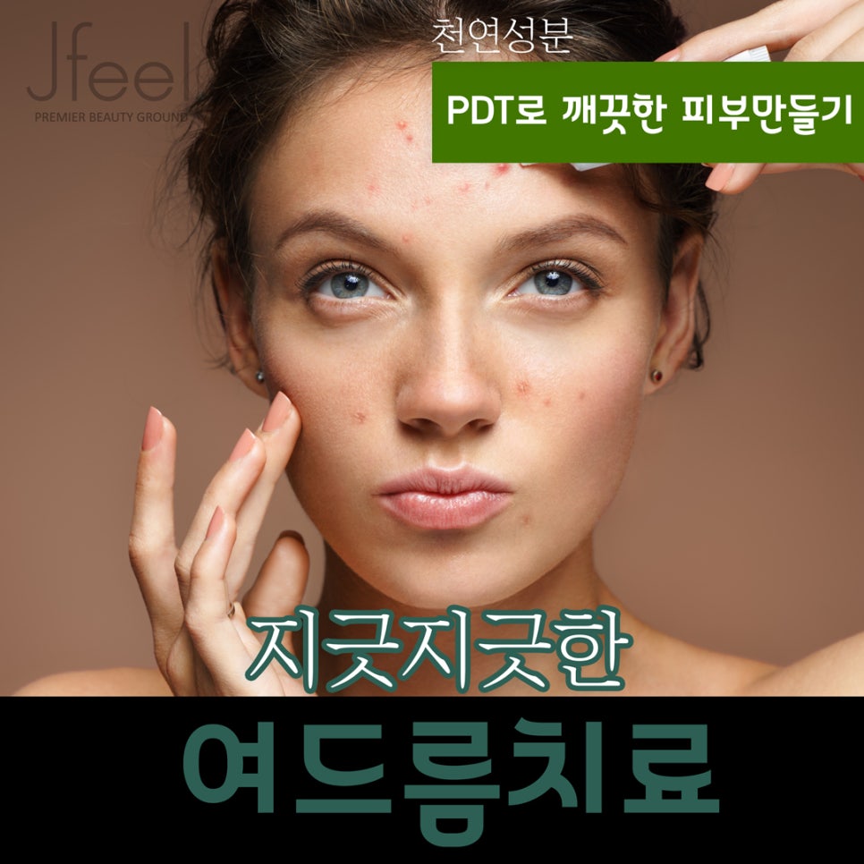 [홍대피부과] 제이필의원의 차원이 다른 천연 PDT 여드름 관리 관련 이미지 1