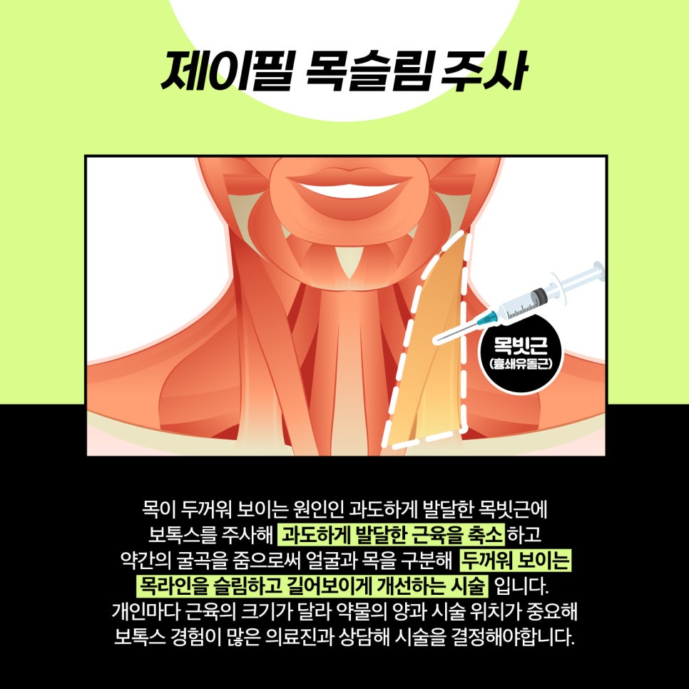 어깨라인 슬림 하게 만들고 싶다면 관련 이미지 4