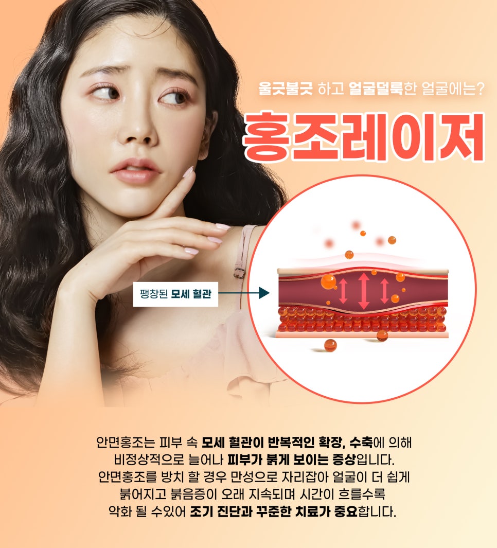 얼굴홍조, 홍당무케어로 화사하게 관련 이미지 3
