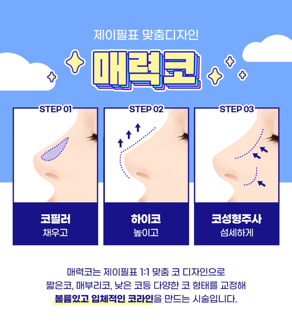 코끝 높이고 콧대채우는 제이필 매력코필러 관련 이미지 2