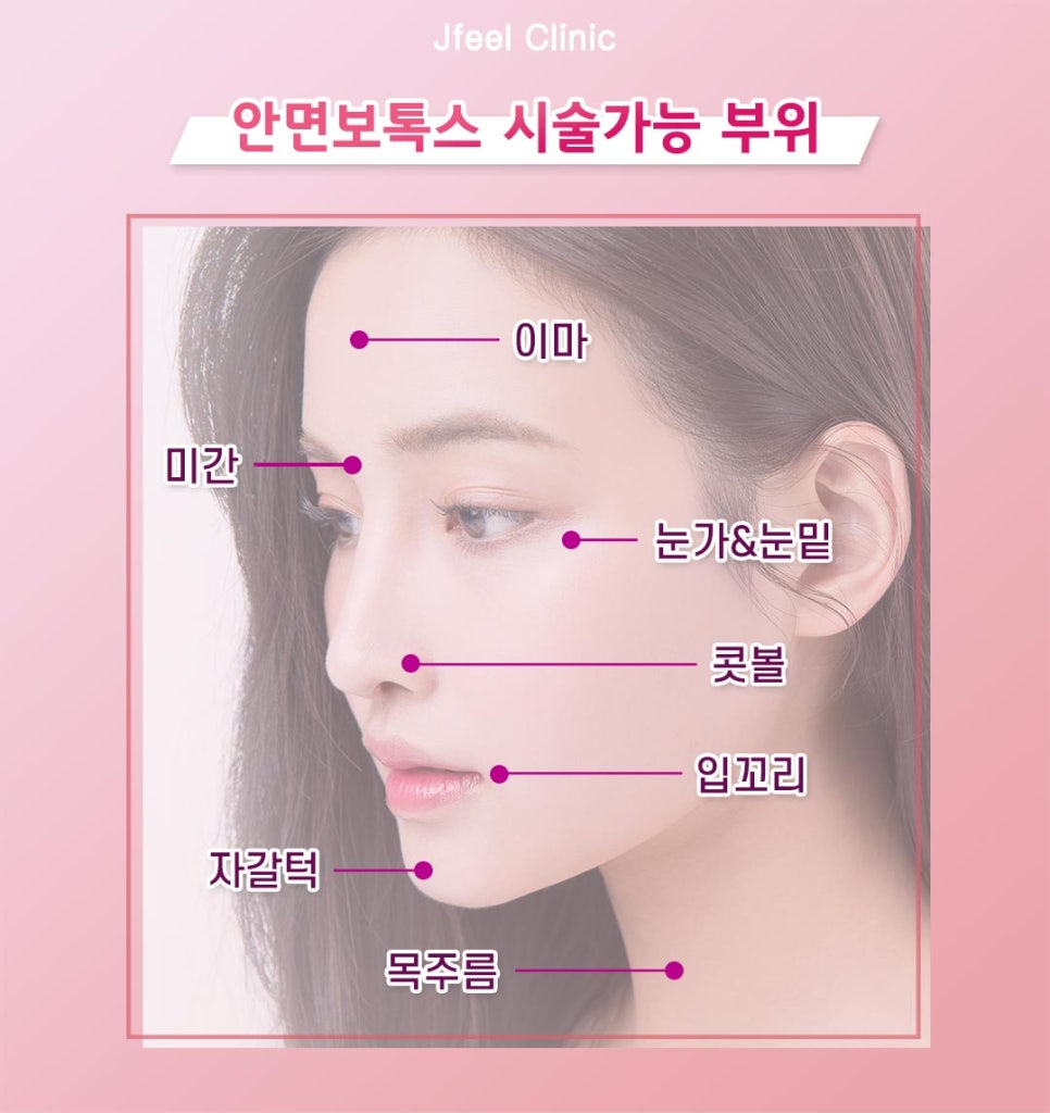 보톡스를 이용한 안면 주름개선과 발달된 근육 축소 시술 관련 이미지 8