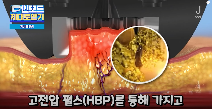 인모드효과 못 보셨다면 여기로 관련 이미지 5