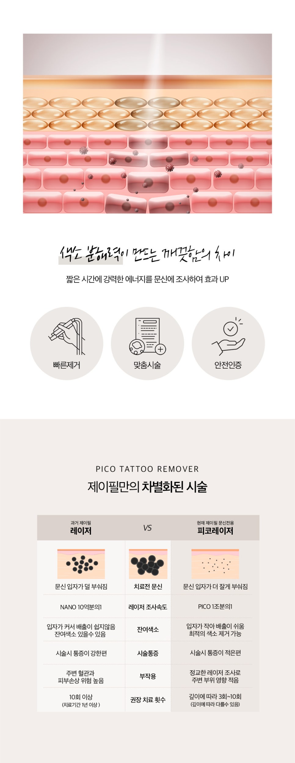 미니타투제거는 피코문신제거 레이저 관련 이미지 3