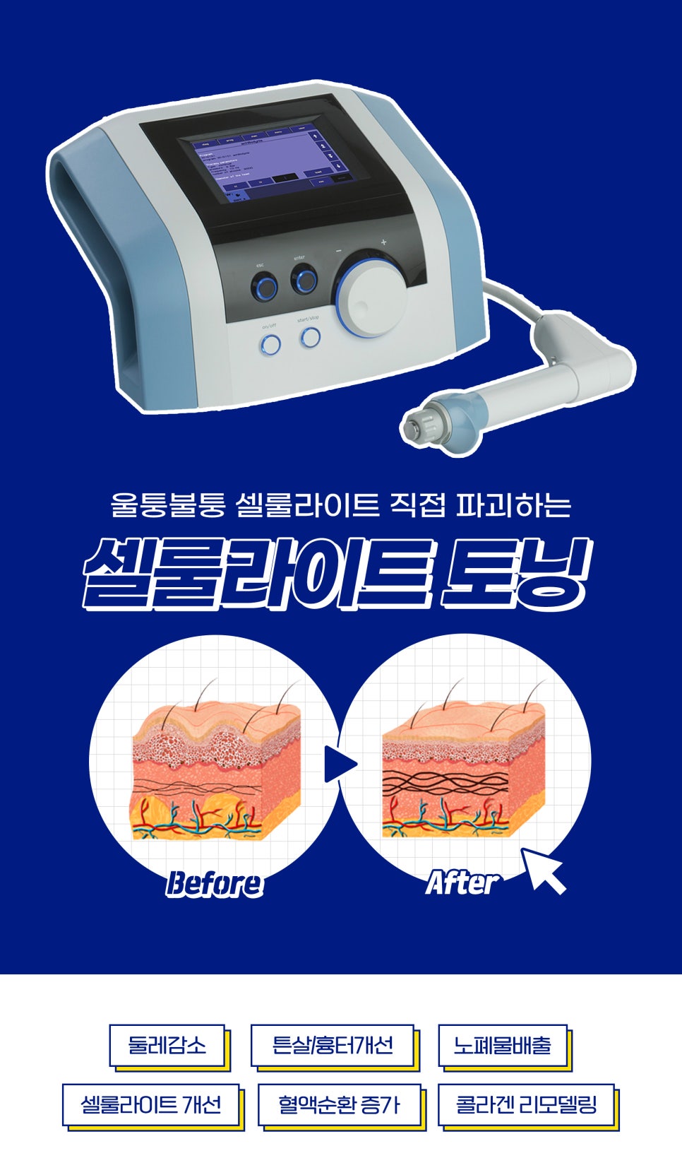 명절후유증, 추천 시술로 날려버리기 관련 이미지 6