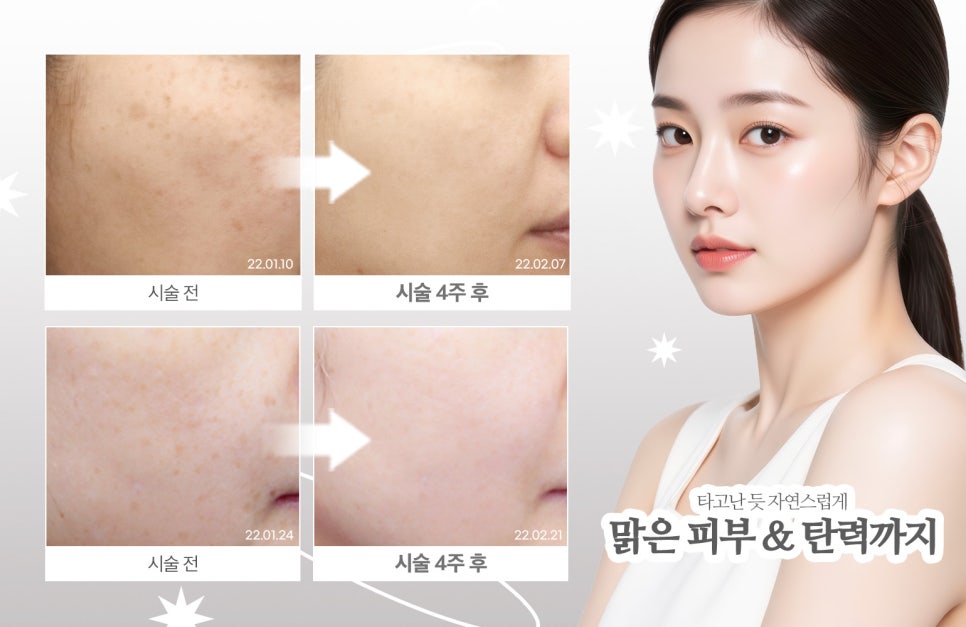 The Key to the Clean Girl Skin Routine | A Complete Guide to Rejuran, 5 Lasers, and Titanium image 10