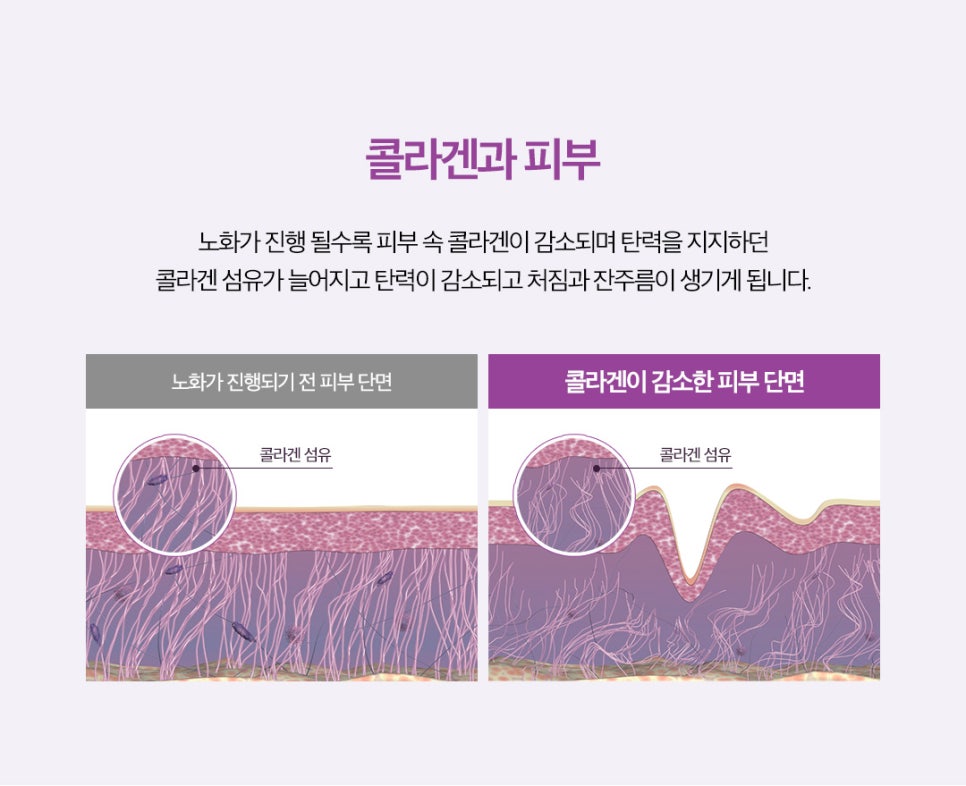 Hongdae Thermage Laser Effect Duration: Which Generation Is Best? image 4