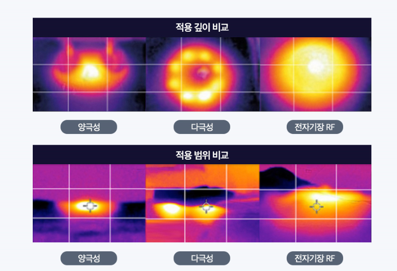 고주파마사지 바디땡김이로 바디리프팅과 지방분해 동시에! 관련 이미지 3