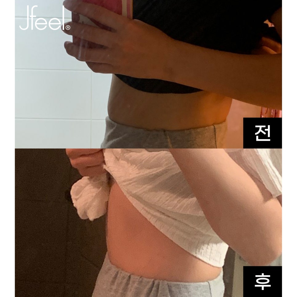 복부지방분해주사 리얼 후기! 효과와 성분도 따져보세요 관련 이미지 2