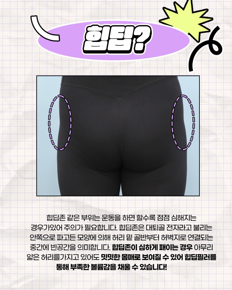 Solving Lower-Body Line Concerns, Creating Apple Hips with J-FILL Hip Filler and Butt Filler image 4
