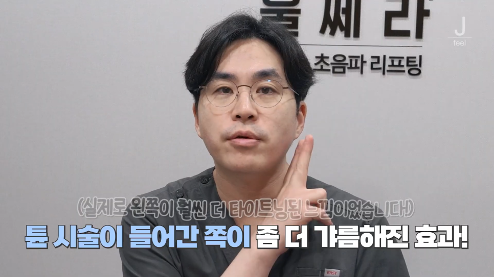 인모드와 튠페이스&튠라이너 차이점 관련 이미지 11