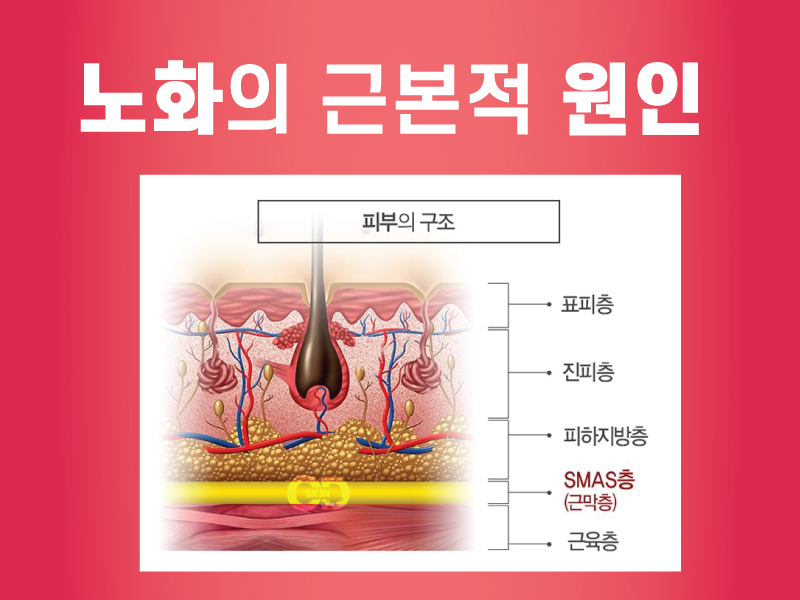 [홍대 피부과] 제이필의원에서 리프팅 묻고 V라인까지 더블로 가! V라인 듀얼 땡김이 리프팅 관련 이미지 2