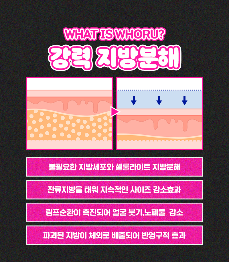 얼굴 전체를 줄이는 강력지방분해 돌려깎기주사 관련 이미지 2
