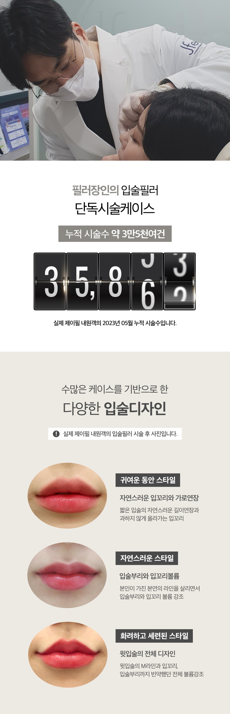 입술전체필러로 탱글 볼륨 만들기 관련 이미지 3