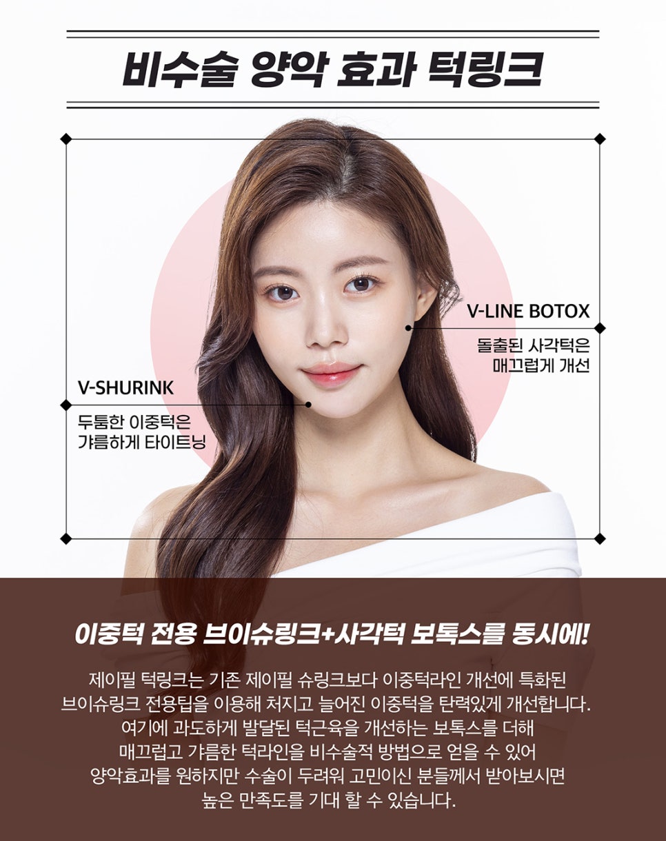 턱슈링크, 브이라인 조각 리프팅 관련 이미지 2