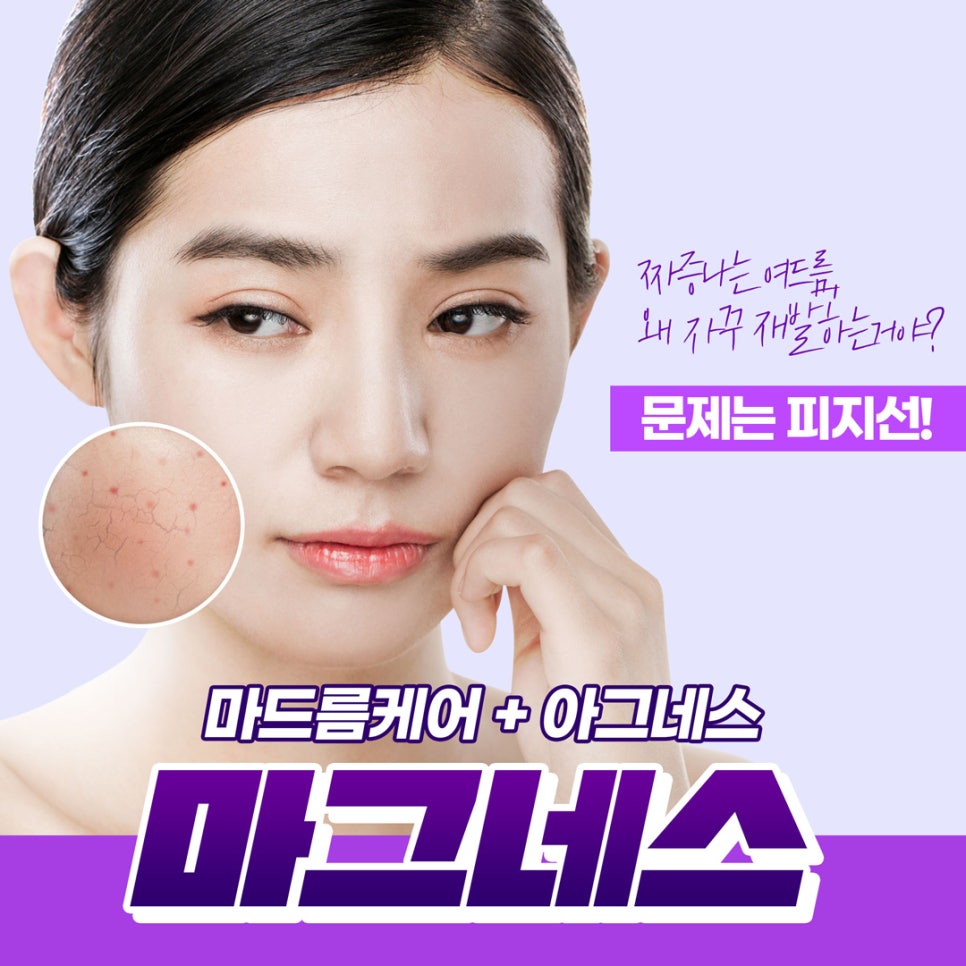 마스크 속 피부 트러블,여드름도 제이필의 마그네스로 케어해보세요 관련 이미지 1