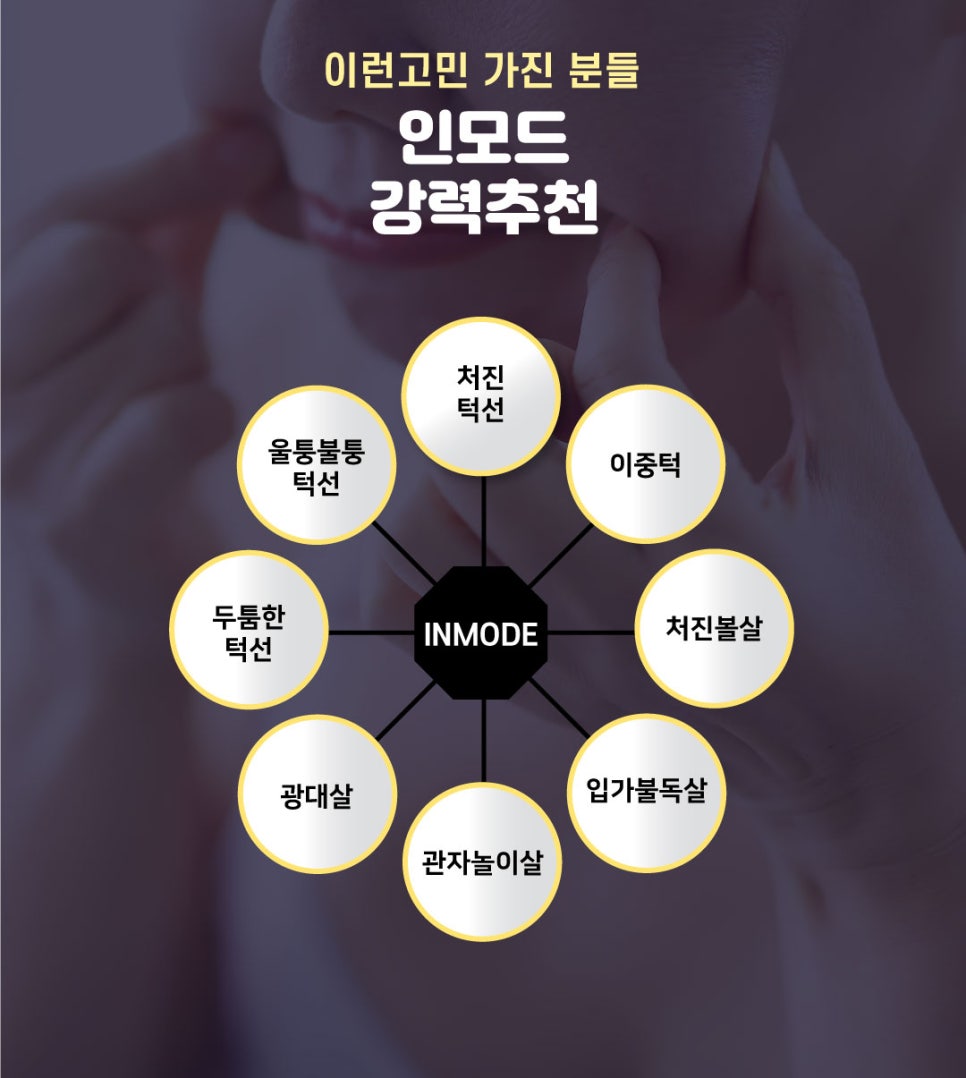 얼굴 라인 정리, 브이라인 리프팅 인모드 제이필의원에서 관련 이미지 8