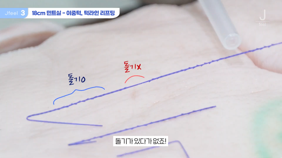 민트실을 돼지고기에 넣는다면? 실리프팅 실험 관련 이미지 10