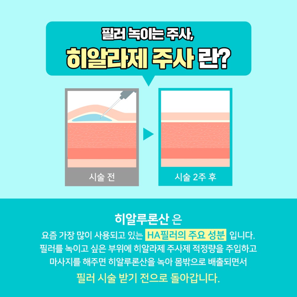 얼굴 동안시술로 자연스럽게 예뻐지고 싶다면? 관련 이미지 12