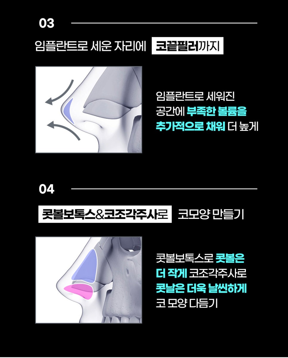 얼굴 동안시술로 자연스럽게 예뻐지고 싶다면? 관련 이미지 11