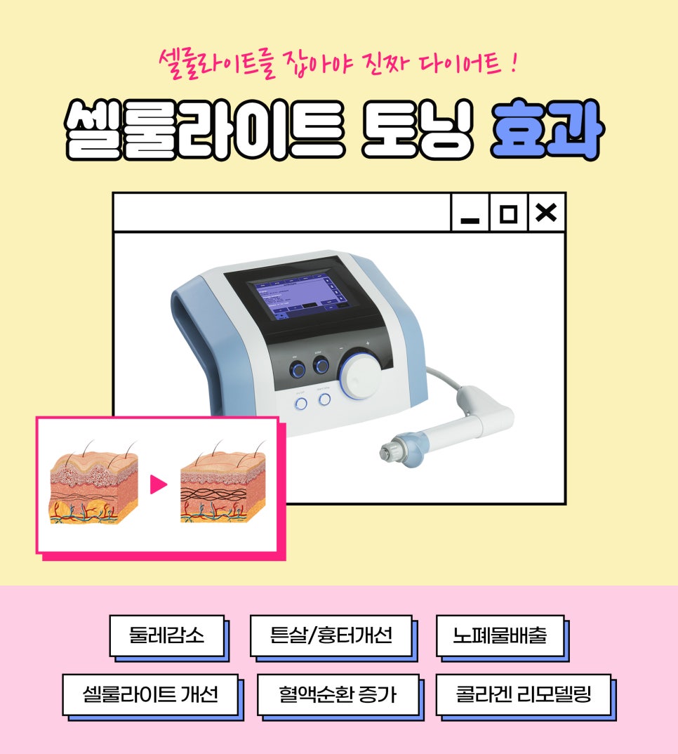 허벅지 셀룰라이트 분해, 제거하는 유일한 방법 관련 이미지 3