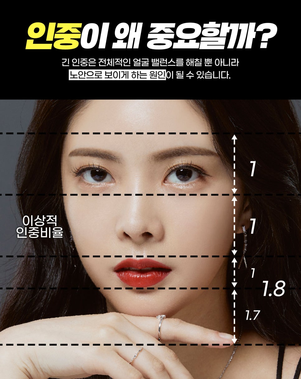 인중축소리프팅 인중축소 탄력올리는 제이필인중올려리프팅 관련 이미지 2