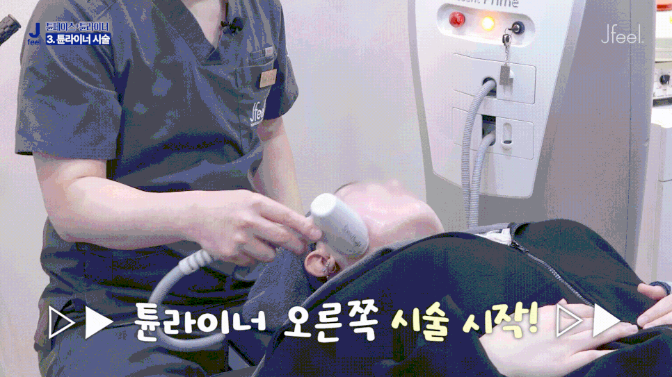 튠라이너 & 튠페이스 시술, 어떤 효과 있을까? 리프팅 + 탄력 관련 이미지 9