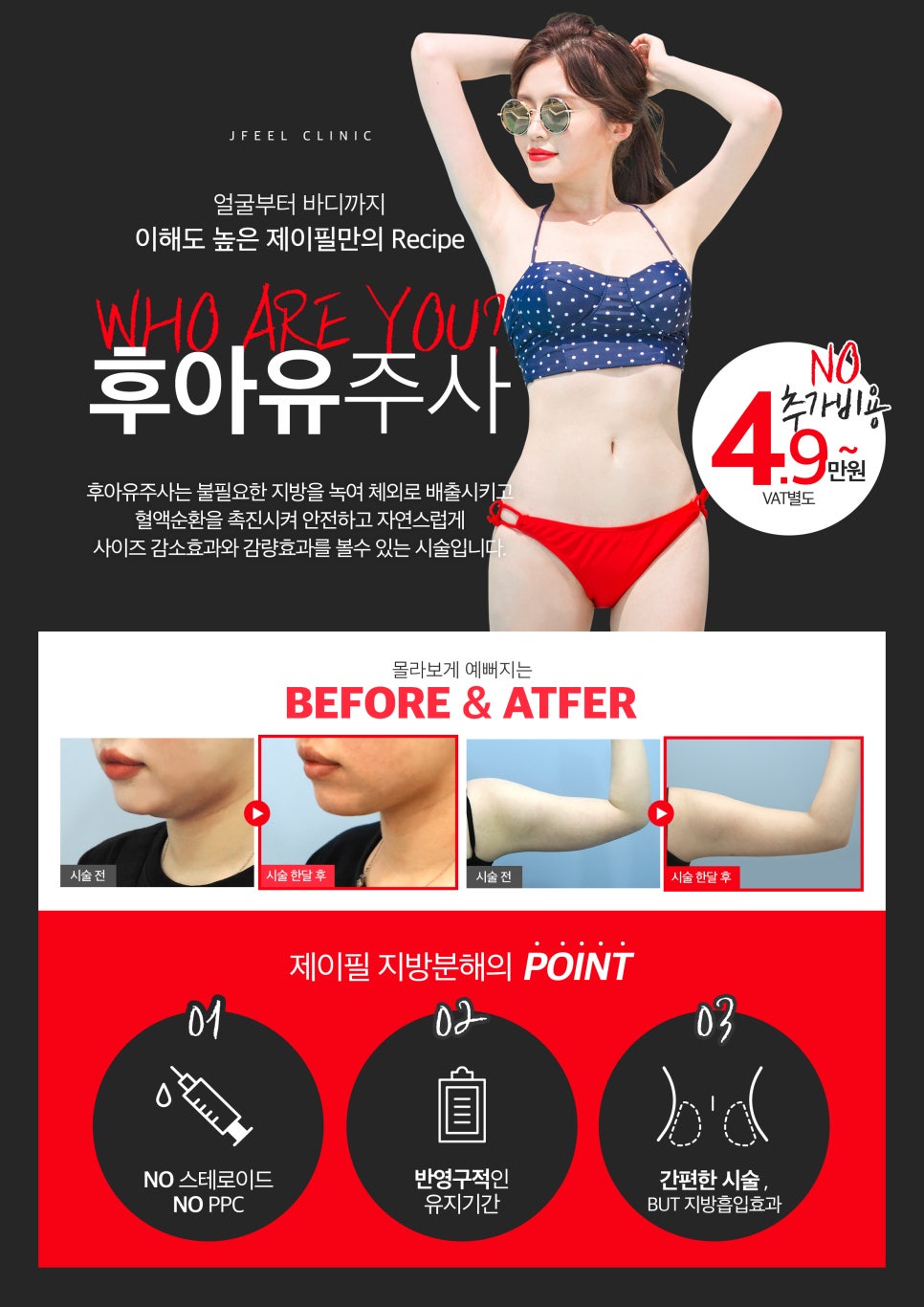 팔뚝, 복부지방분해주사 성분이 다르면 효과도 달라지나요? 관련 이미지 6