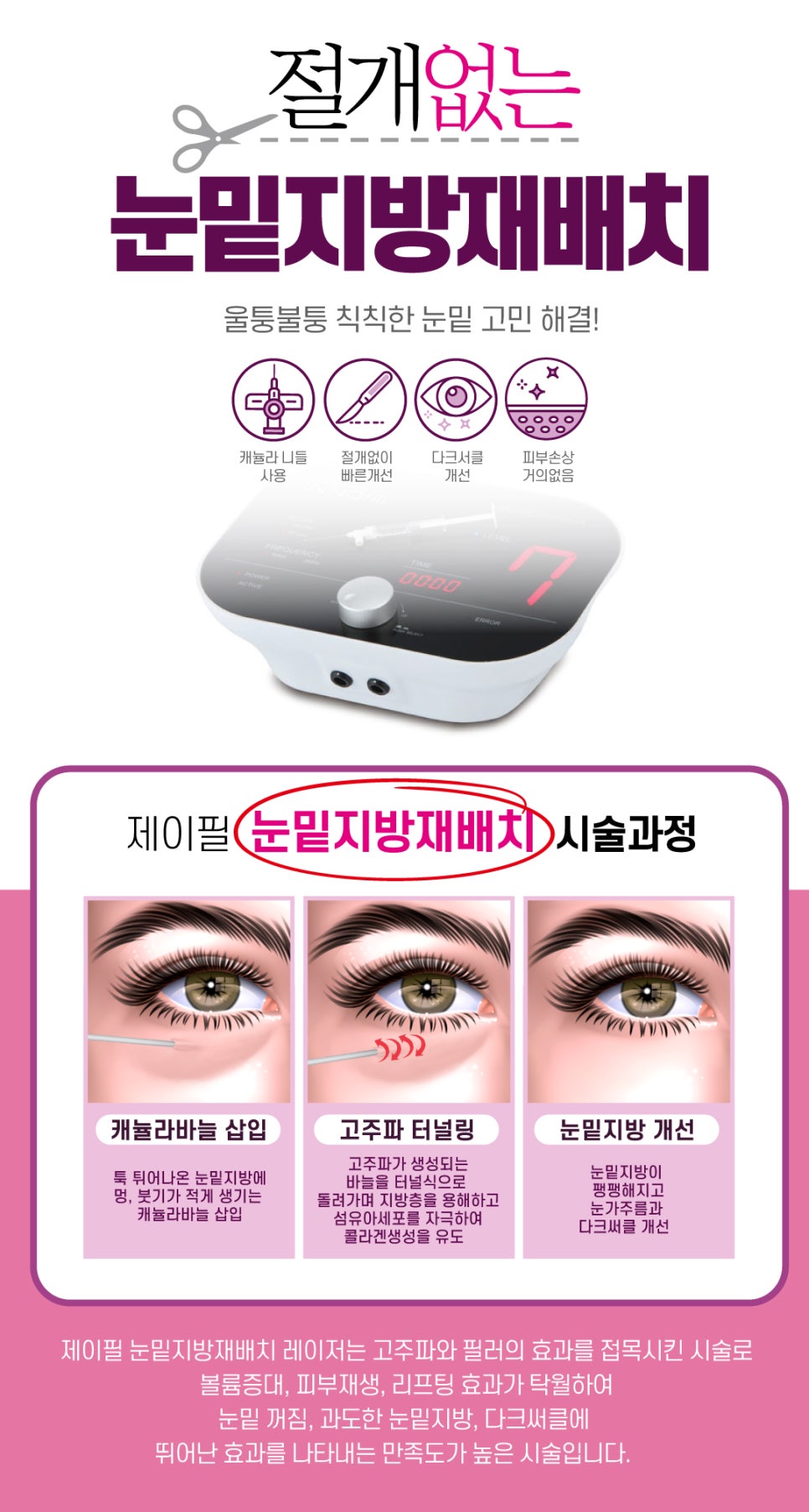 눈밑지방재배치 레이저 , 절개 없이 가능할까? 관련 이미지 3