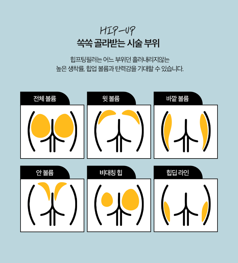 Solving Lower-Body Line Concerns, Creating Apple Hips with J-FILL Hip Filler and Butt Filler image 11