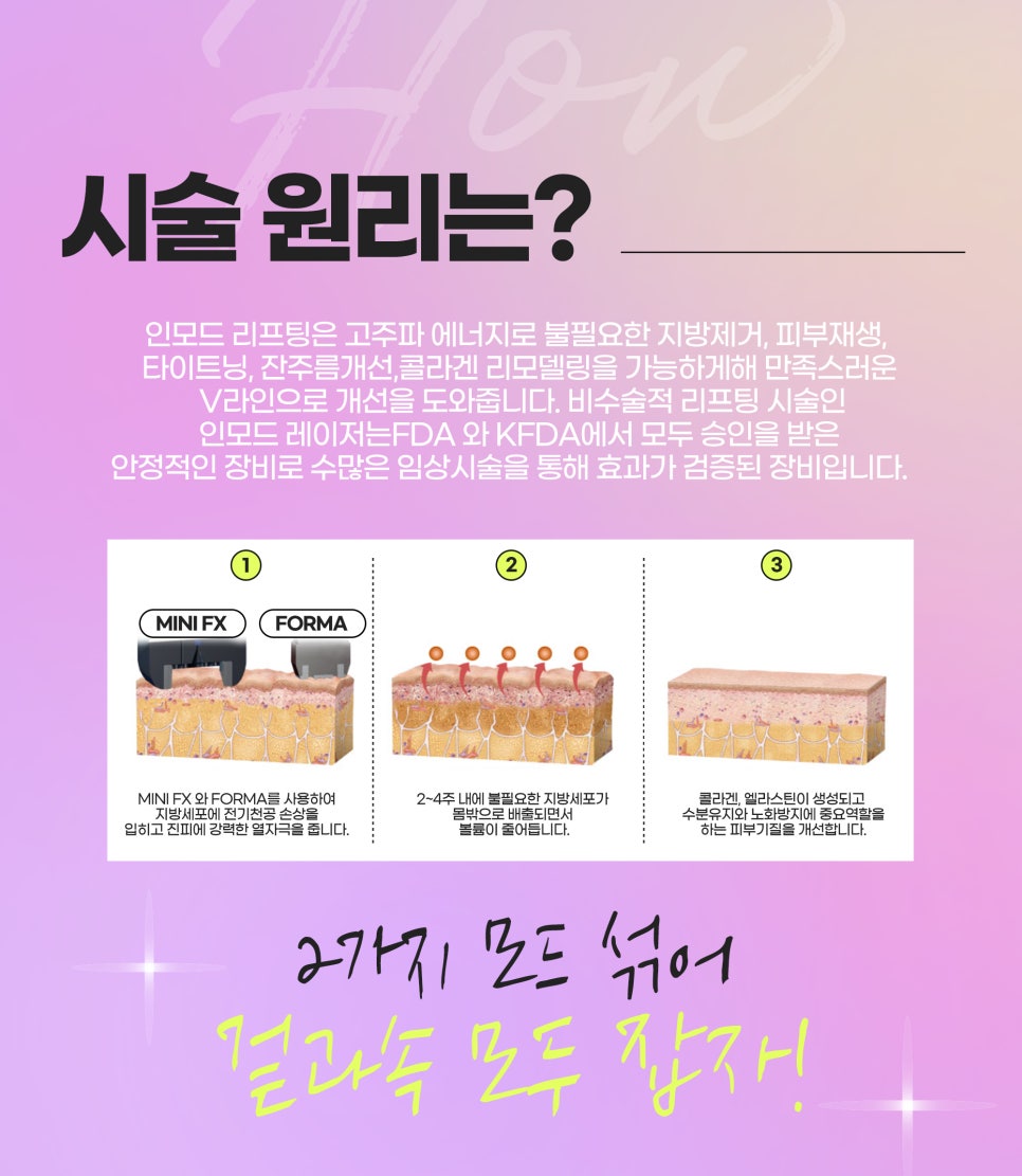 얼굴라인정리, 트리플 착붙인모드로 한 번에 관련 이미지 5