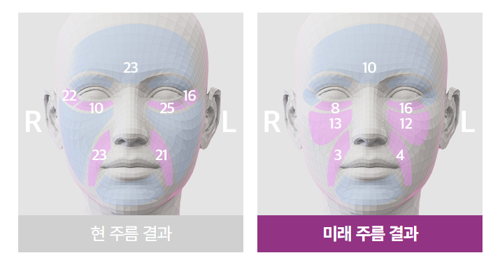 Summer Sebum · Pore · Lifting Care Guide|Jfeel Clinic July Programs image 12