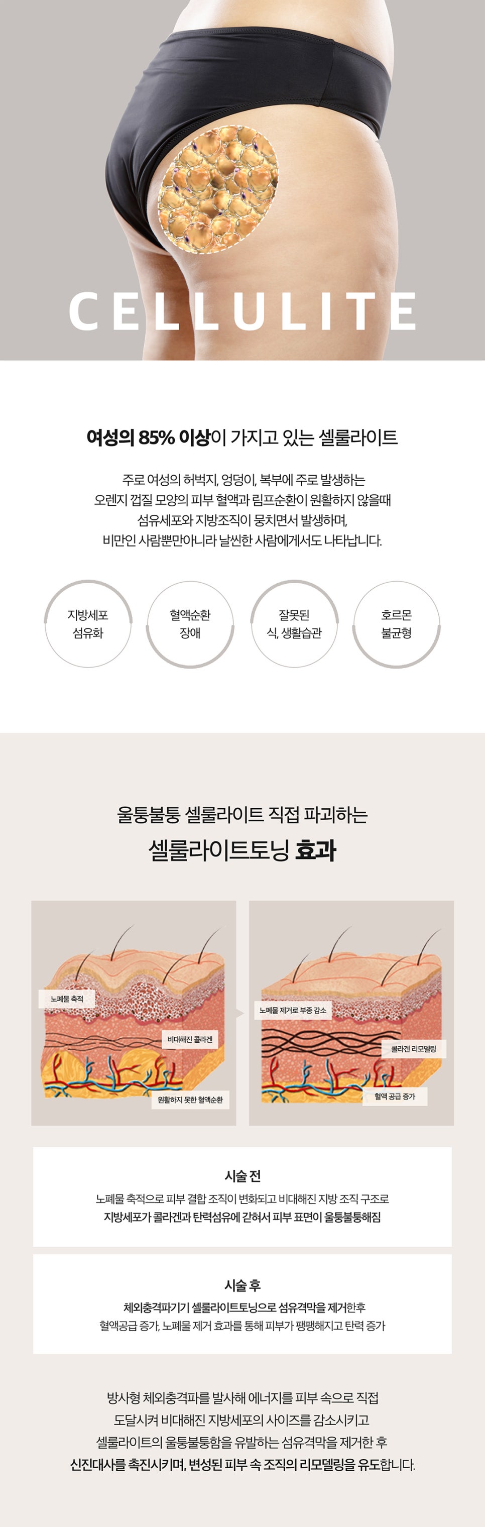 하체관리 방법 추천, 여름맞이 패키지 관련 이미지 3