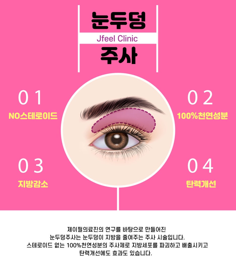 &ldquo;뚜렷한 눈&rdquo; 수술없이 주사로 1분이면 OK 눈두덩이 주사 관련 이미지 2