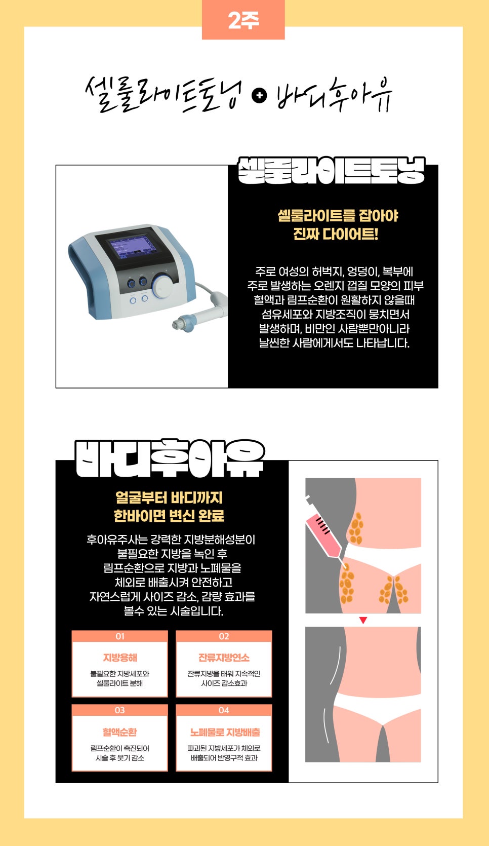 비키니몸매, 4주 패키지로 핫하게 완성 관련 이미지 4