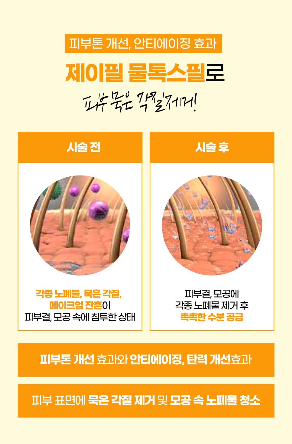 수면울쎄라로 통증 없이 얼굴 탄력 높이기 관련 이미지 8