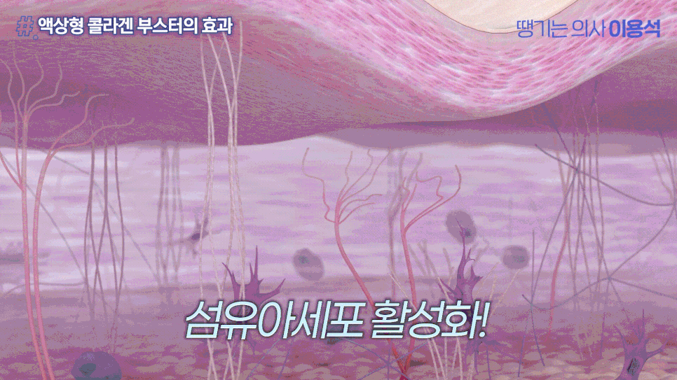 휴가 다녀왔더니 피부가 확 늙어 보인다? 여름철 피부관리 고우리 콜라겐부스터 관련 이미지 12