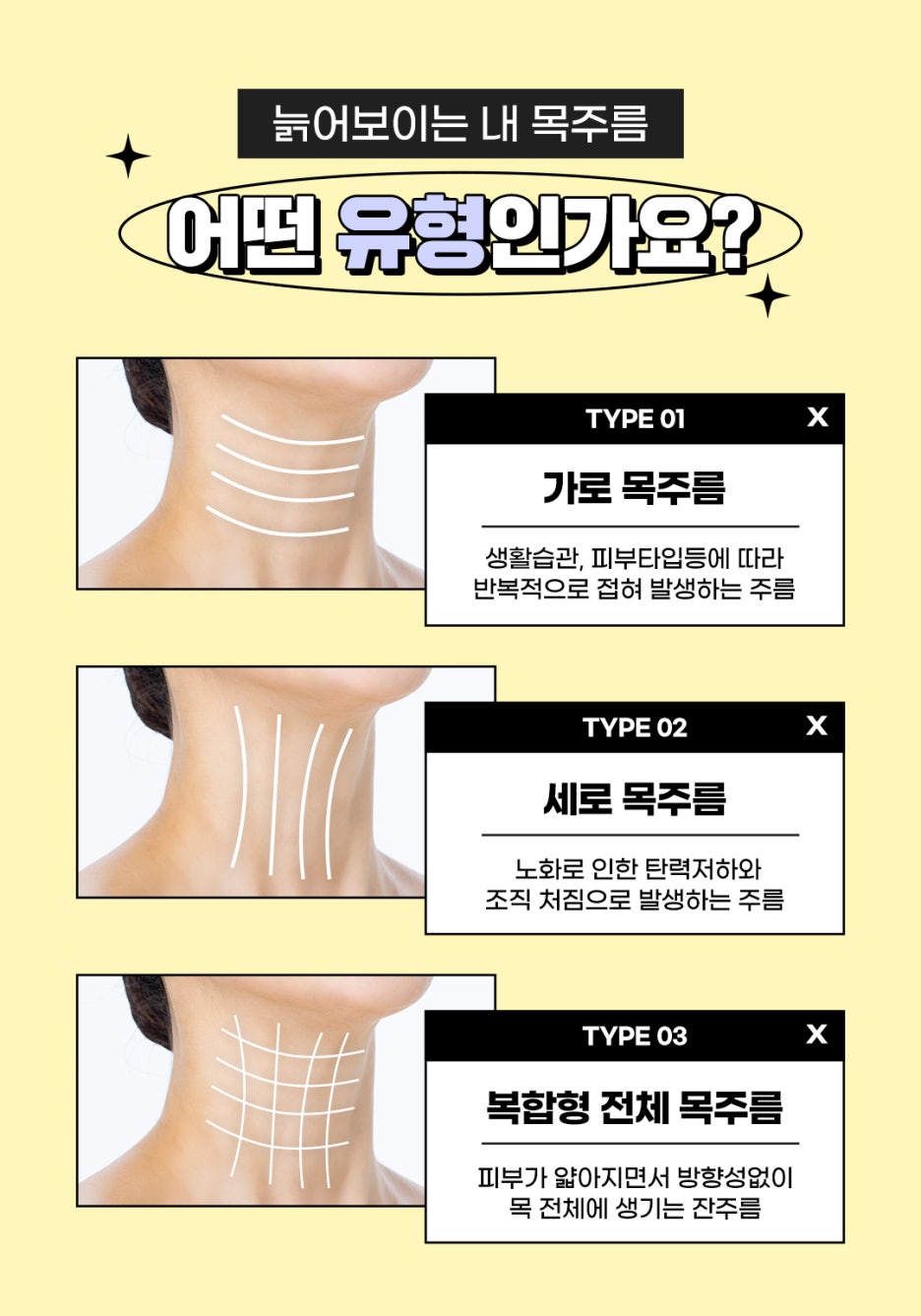 가로세로목주름 목주름필러시술로 20대부터 관리해보세요 관련 이미지 2