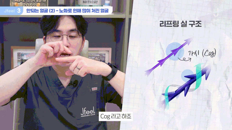 실리프팅 종류가 너무 많아요, 저는 뭘 해야 하나요?｜민트실&middot;잼버실&middot;실루엣소프트 비교 관련 이미지 19