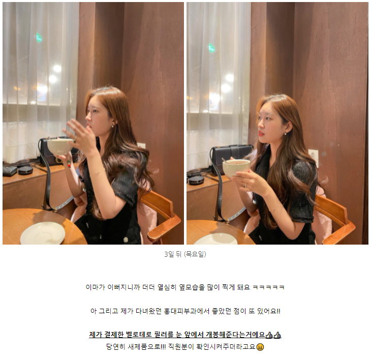홍대 이마필러 잘하는 곳, 벨로테로 리얼 후기 관련 이미지 3