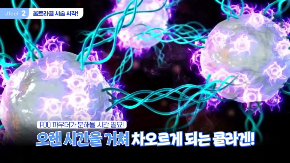 필러가 싫다면? 눈가, 팔자, 주름 해결하는 울트라콜 관련 이미지 8