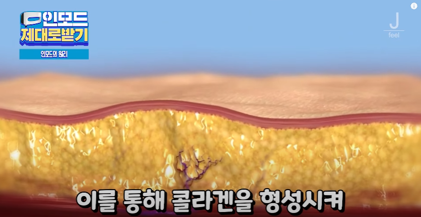 인모드효과 못 보셨다면 여기로 관련 이미지 8