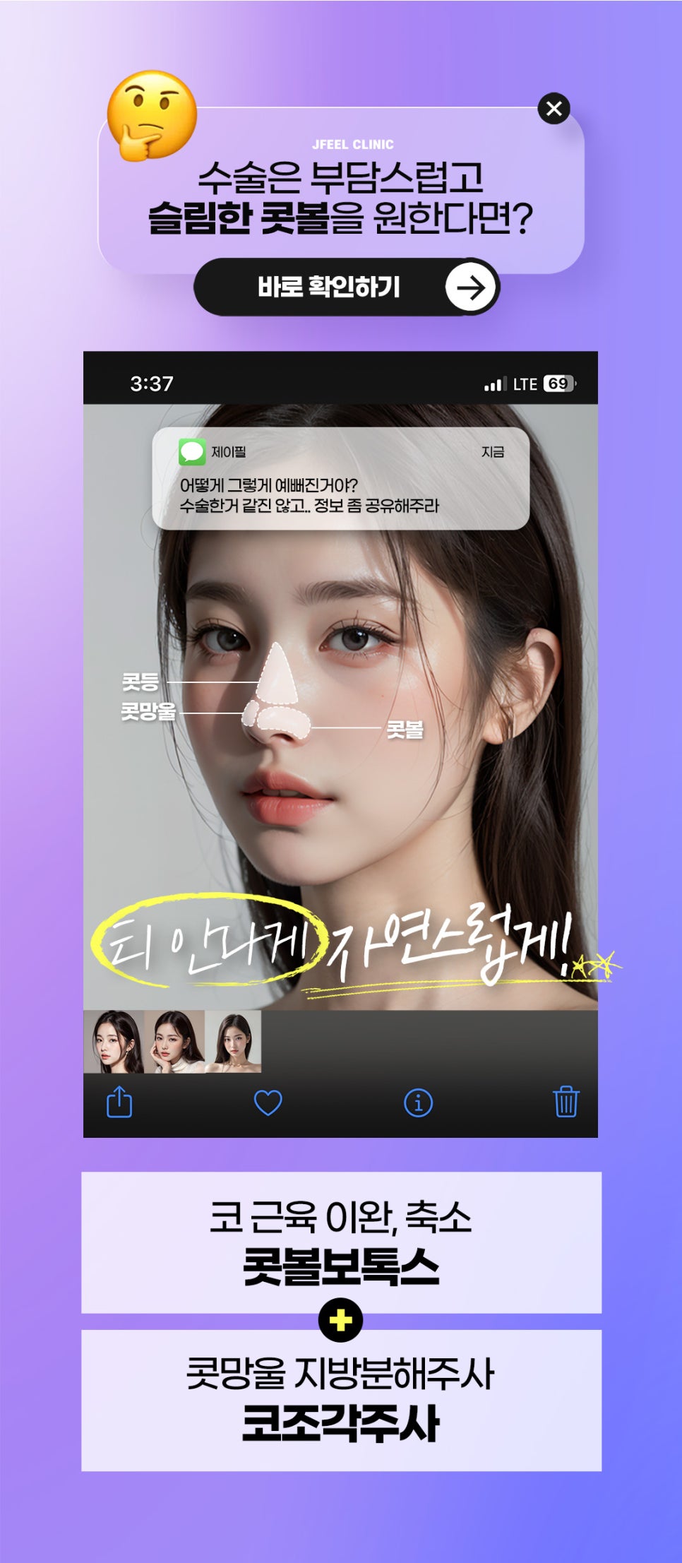 콧구멍줄이기는 콧볼보톡스와 코조각주사 조합 관련 이미지 4