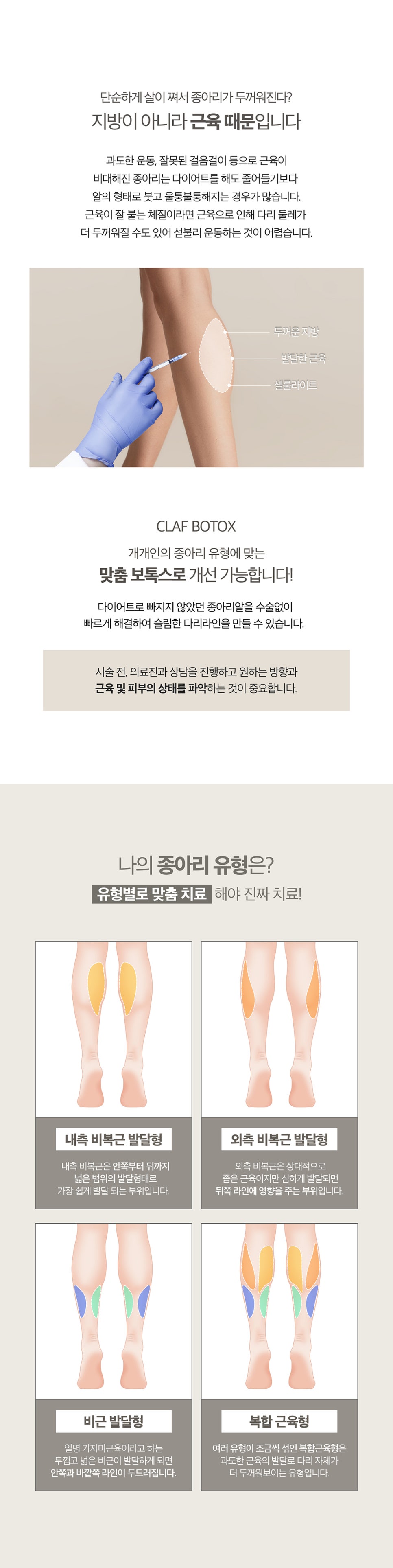 종아리관리는 종아리보톡스로 슬림 하게 관련 이미지 2